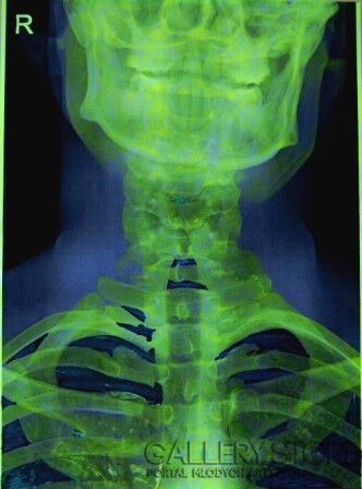 Green Skull