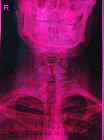 Michał Król-Pink Skull-Technika mieszana